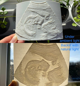 3D Baby Ultrasound Lithophane Photo - Made in Canada