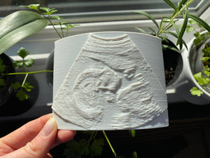 3D Baby Ultrasound Lithophane Photo - Made in Canada